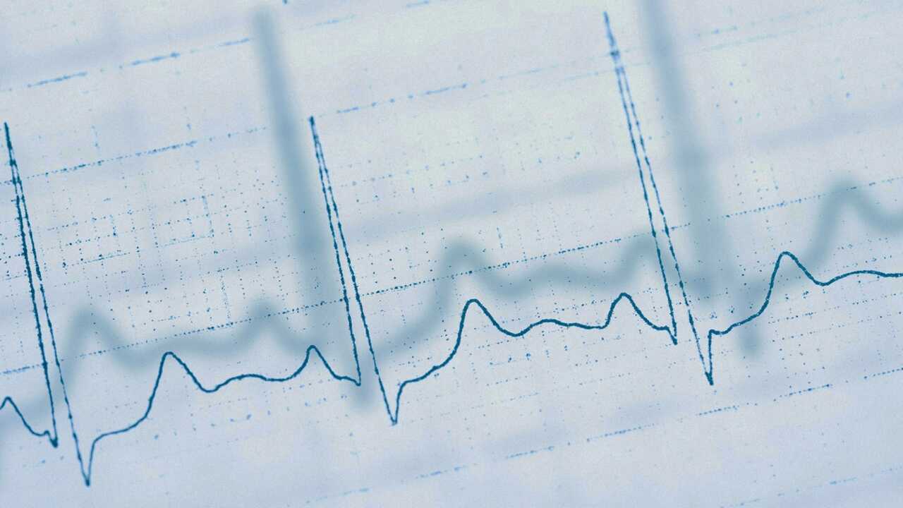 В Казахстане ИИ научат выявлять риск сердечной недостаточности